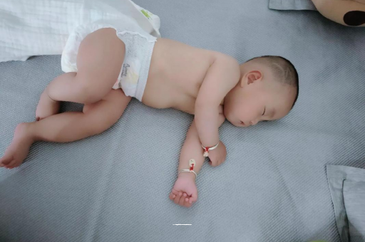 府谷六个月宝宝眼睛散光